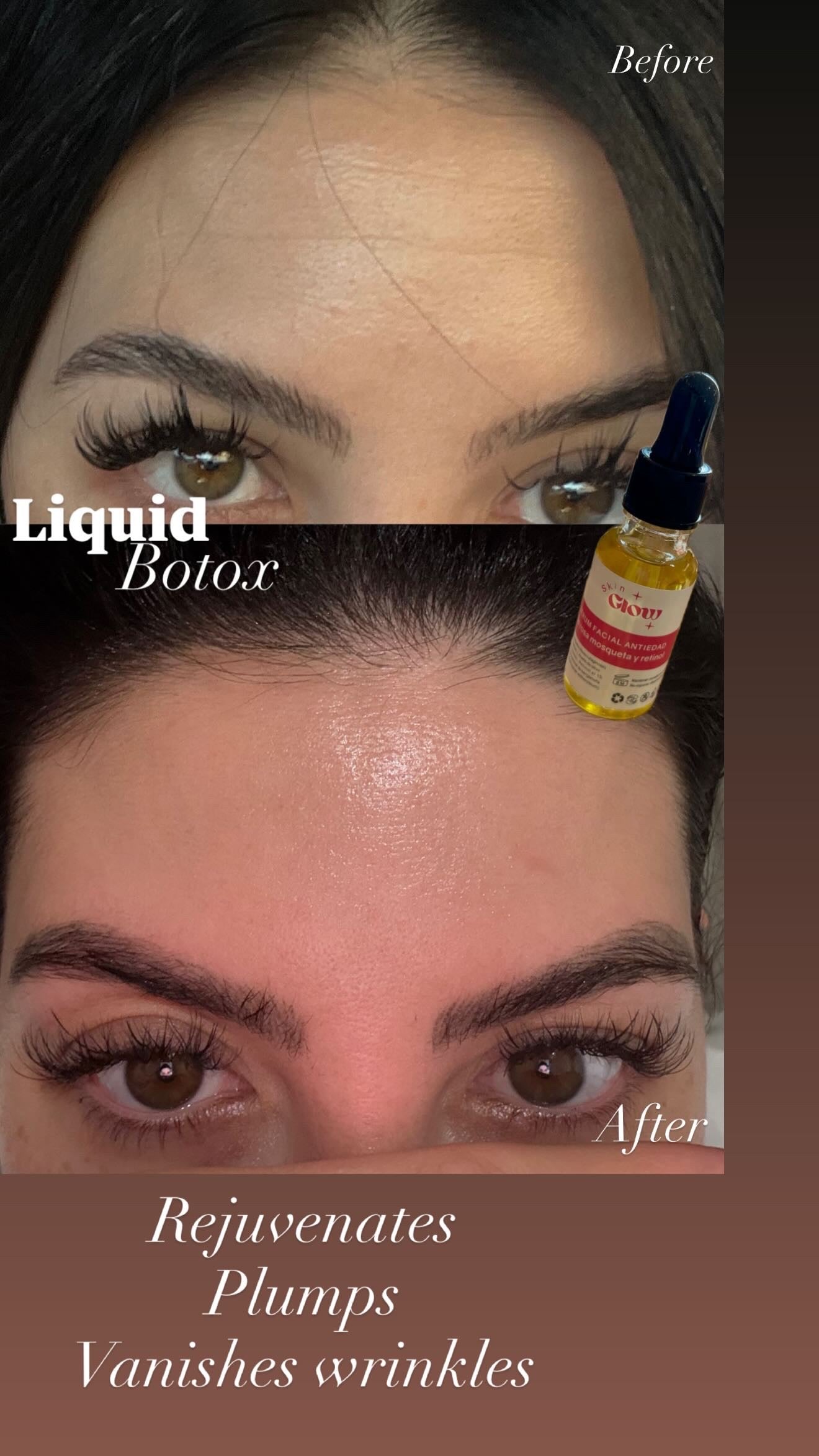 ACEITE DE ROSA MOSQUETA Y RETINOL