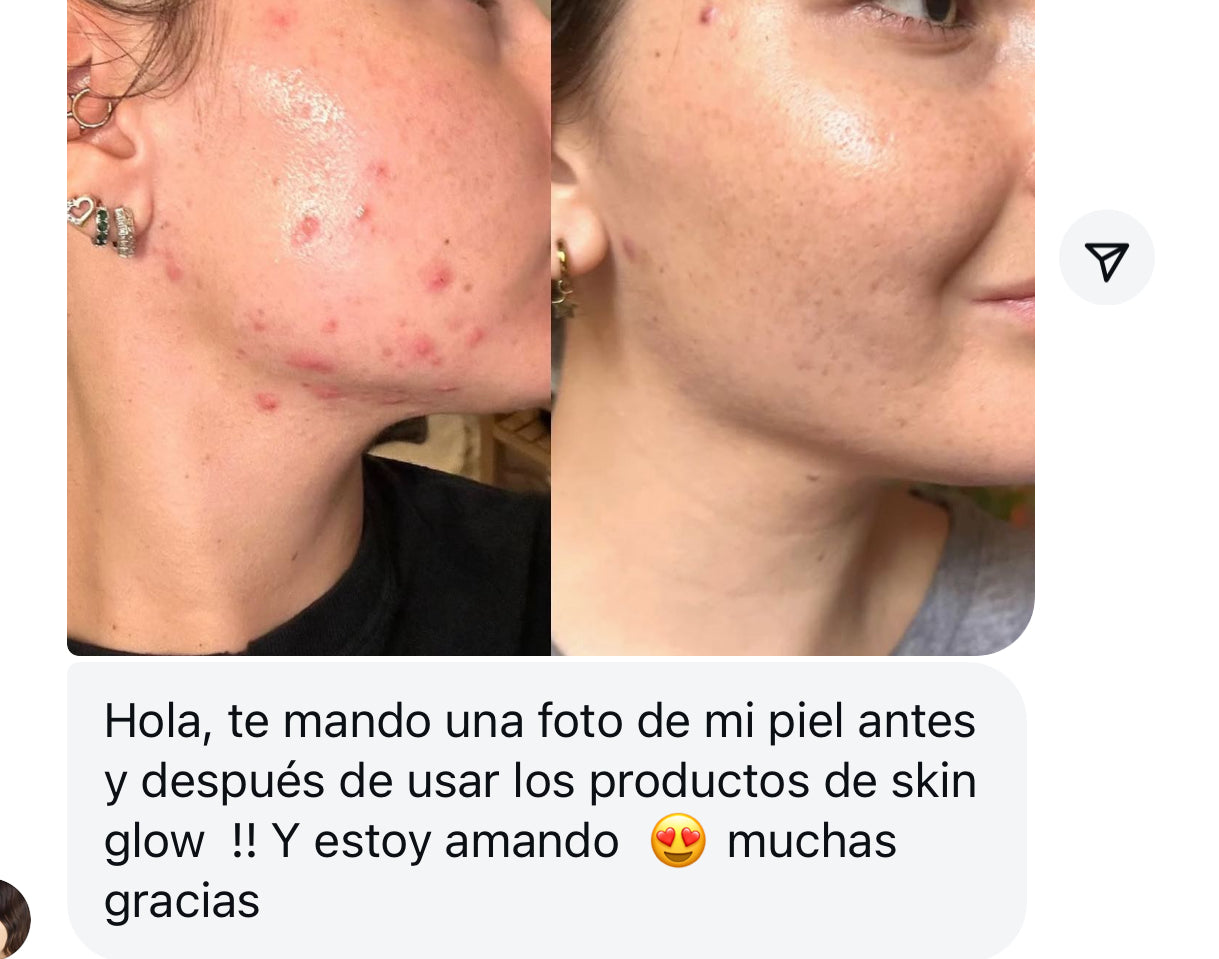 LIQUID GOLD SERUM