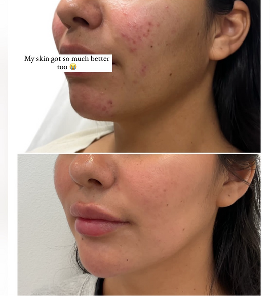 LIQUID GOLD SERUM